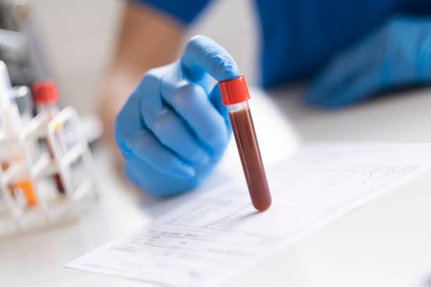 Best Lab For Blood Test Near Me